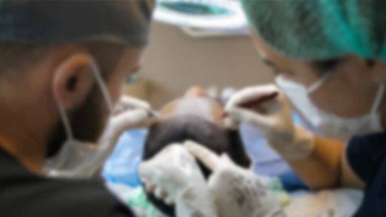 HAIR TRANSPLANT